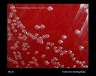 Neisseria meningitidis on blood agar